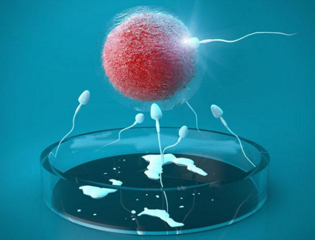 试管婴儿分娩方式选择与孕期护理指南