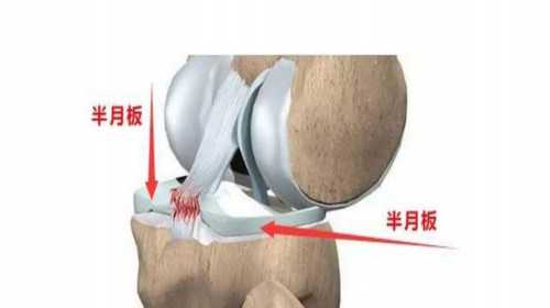 杭州借供卵试管第三代试管辅助妊娠机构无创DNA及羊膜穿刺适用人群