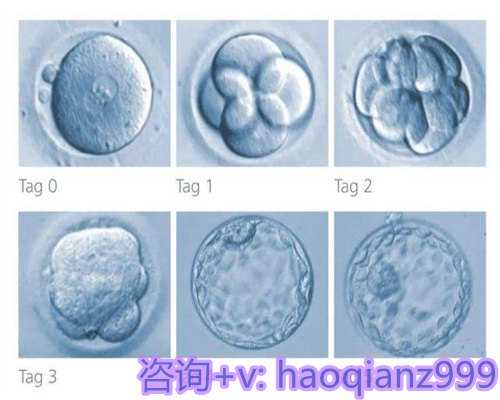 温州供精试管预产期延迟原因解析与应对措施